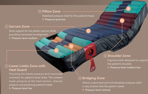 Carilex TheraFlo AP Low Air Loss Hospital Mattress System for Advanced Pressure Injury Prevention therapy zones